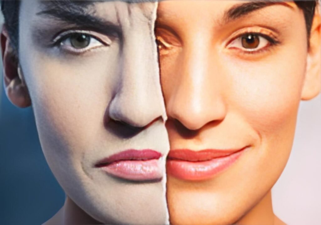Bipolar Disorder