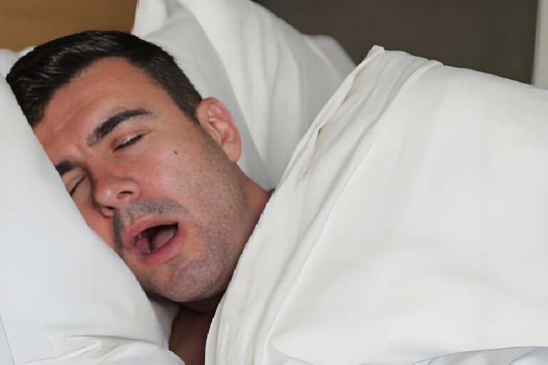 Narcolepsy